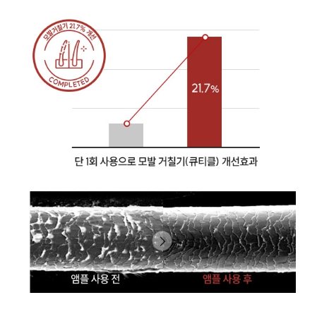 케어 검사결과 이미지