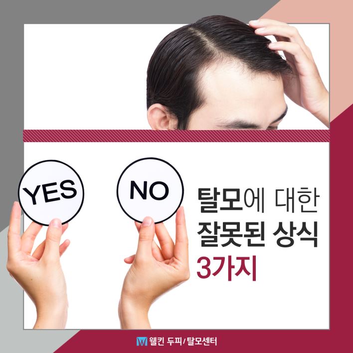 탈모에 대한 잘못된 상식 3가지